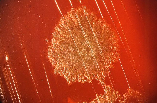 Clostridium botulinum, la bacteria causante del botulismo