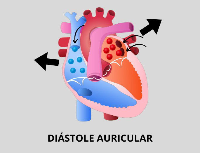 Esquema Diástole Auricular