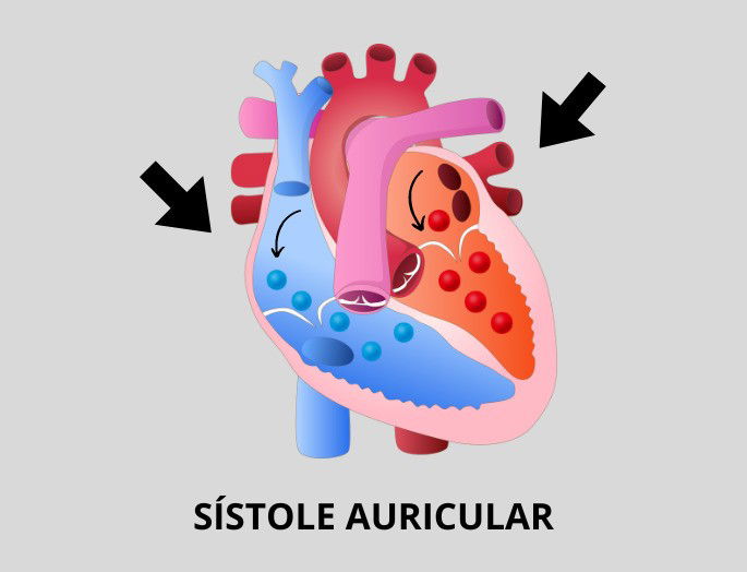 Esquema Sístole Auricular