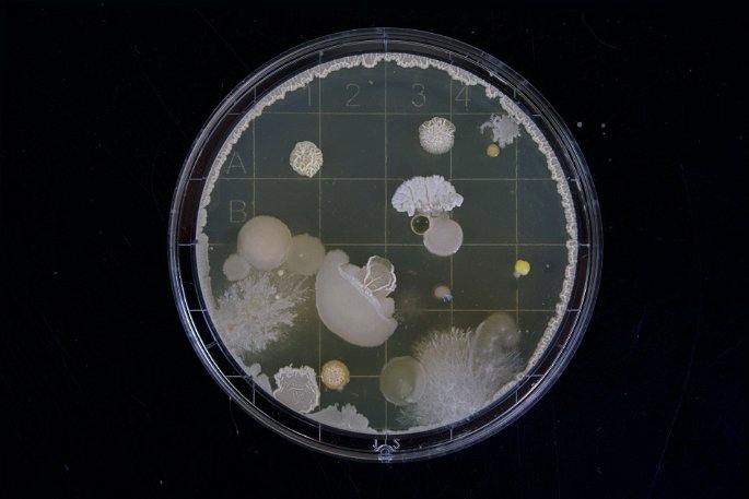 Una placa que contiene microorganismos reproduciéndose