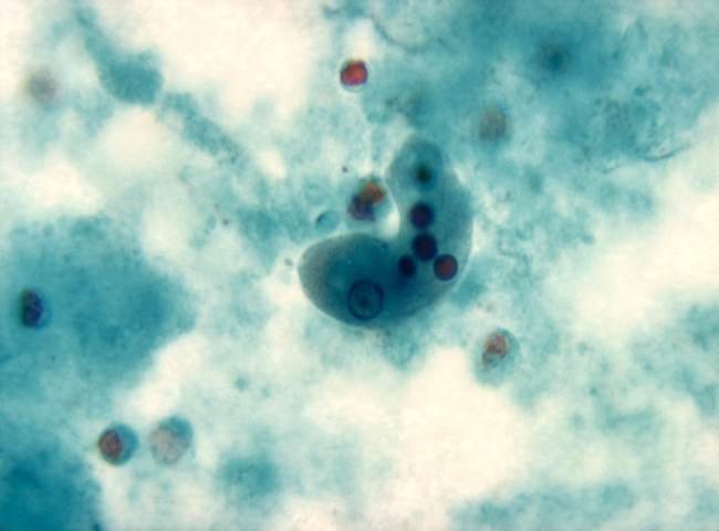 ameba vista con un microscopio