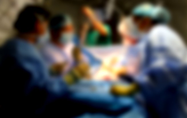 grupo de cirujanos en una sala de operacion