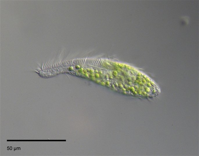 protista unicelular Stichotricha sp. vista en microscopio